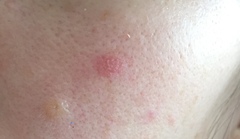 Should I get this checked out?