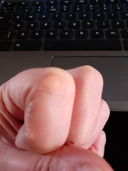 What is this lump (pic included)