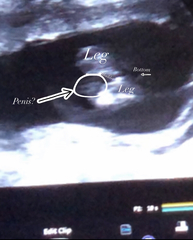 Potty shot / gender scan help