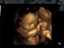 👣 Due Nov/Dec 👣 the second trimester continues