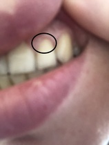 Can't stop thinking about receding gums, I'm terrified - any advice? - Photos inc