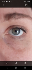 Would anyone be able to tell me if I have hooded eyes?
