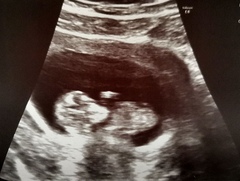 Can you guess what my baby's gender is?