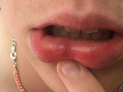Lump/spot in my DS’s mouth