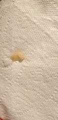 *TMI* Blob of stringy mucus after day of moderate cramping