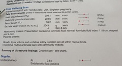 Growth scan-Baby measurements at 33 weeks