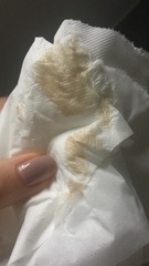 Pregnant After MMC - Thread 2