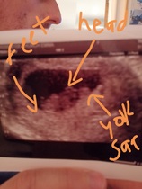 March 2021 #2