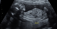 January 2021 due date bus 4