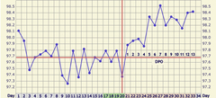 BBT still above coverline after bleed. Help?