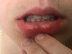 Lump/spot in my DS’s mouth