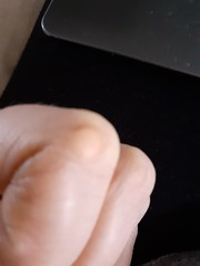 What is this lump (pic included)