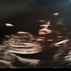 Can you guess what my baby's gender is?