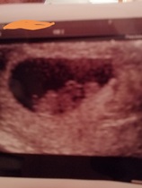 March 2021 #2