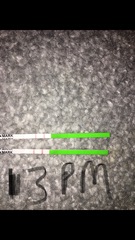 Do you think I’m ovulating? Photo attached
