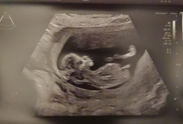 March 2021 #4