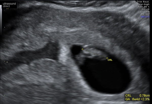 Due May 2021 Thread 2