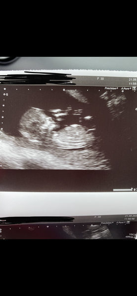 Girl or boy?! Finding out on Friday!