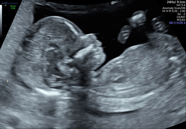 March 2021 #3