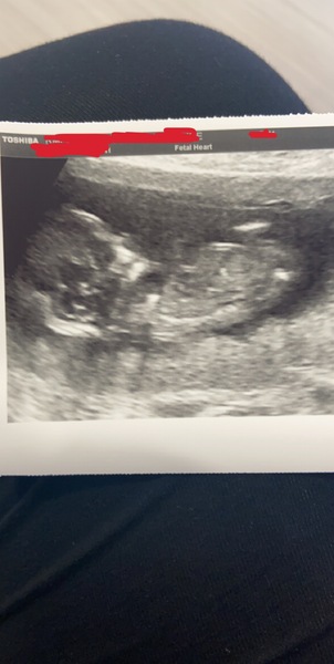 Boy or girl👶🏻