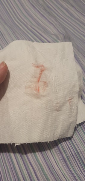 Blood in EWCM, help! (Picture warning)