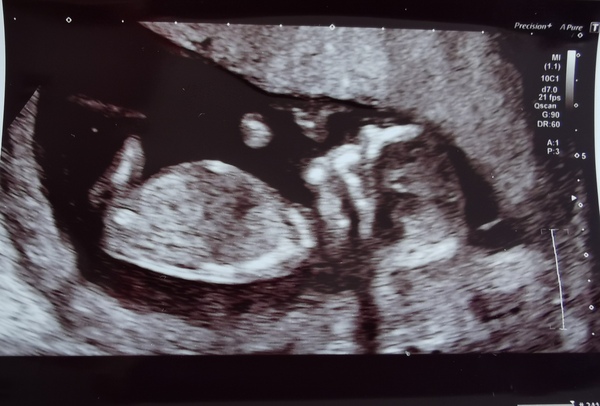 March 2021 #4