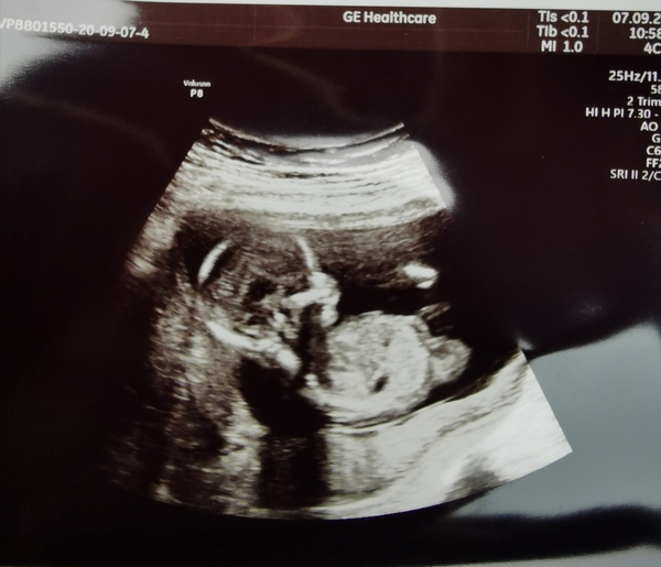 Boy or girl!! ❣️ Any guesses?