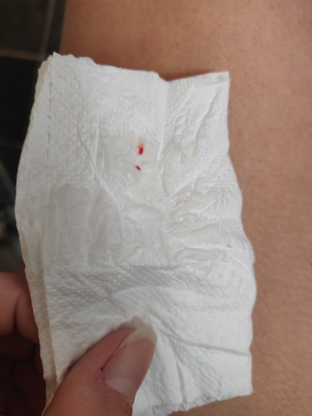 2 days late BFN- What is the latest anyone has had a BFP...