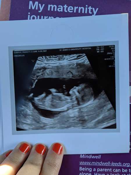 TTC after MC - September 2020 (Thread 13)