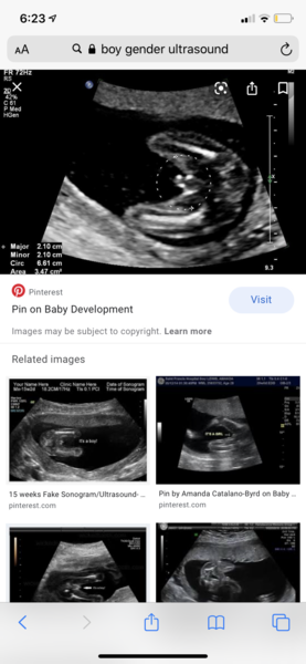 Gender scan photos, what do you think!