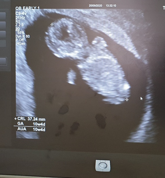 Due April 2021