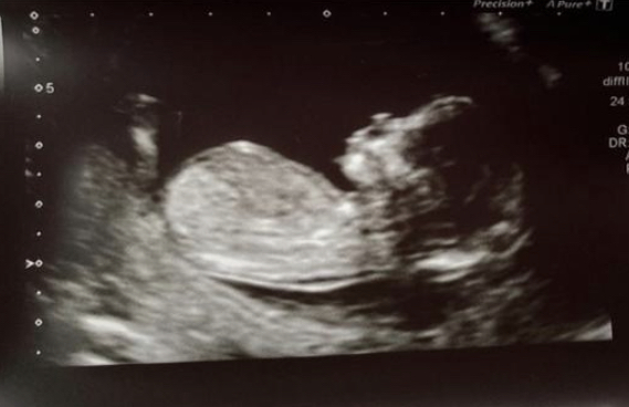 March 2021 #4