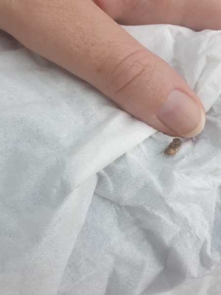 Who wants to see what just came out of my ear? I know you all do you filthy lot