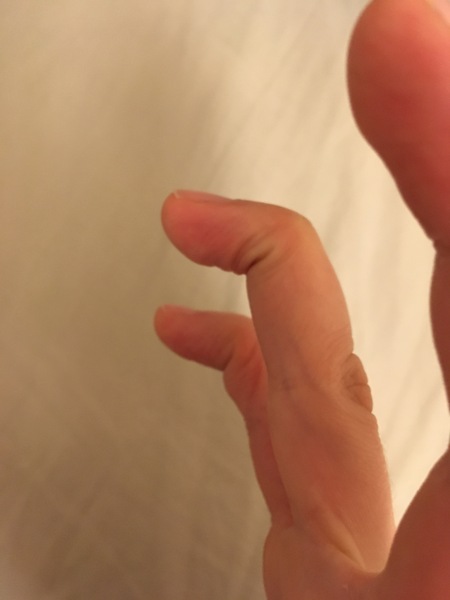 Is my thumb weird?