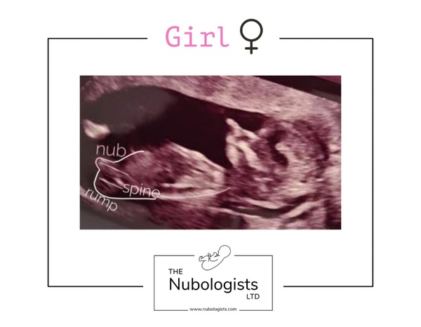 March 2021 #4