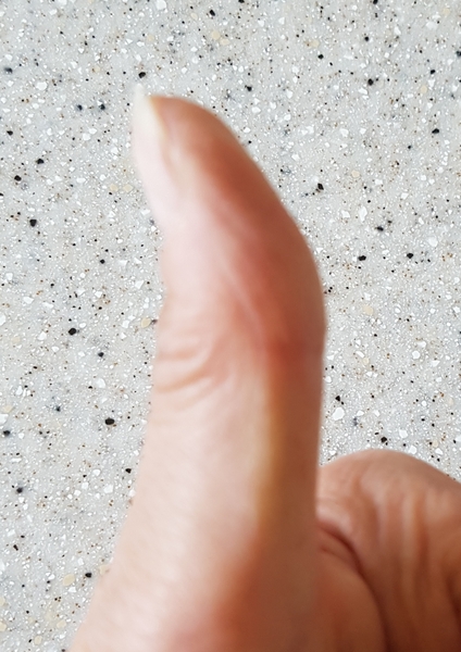 Is my thumb weird?