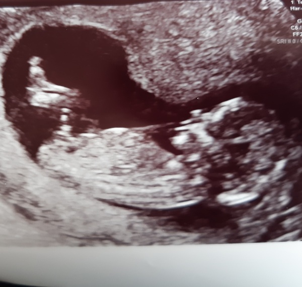 March 2021 #4