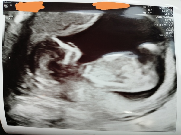 March 2021 #4