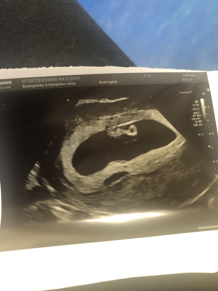 BFP rainbow babies
