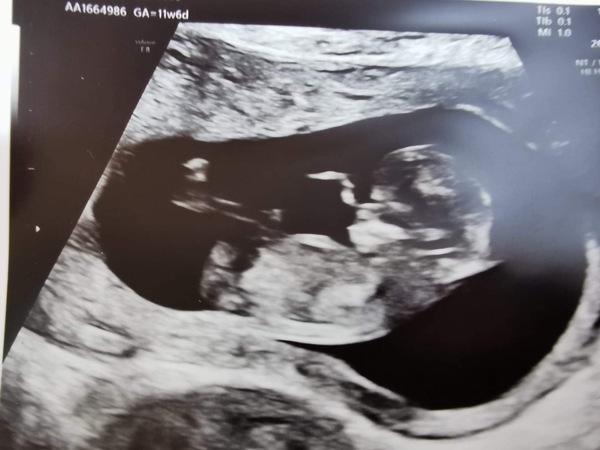 Boy or girl 💗💙