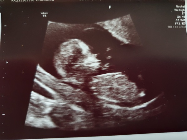March 2021 #2