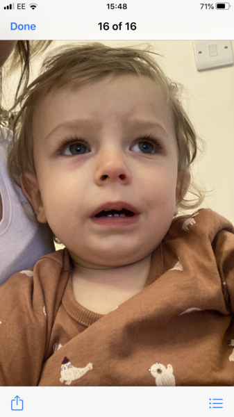 Toddlers eye - what is this?