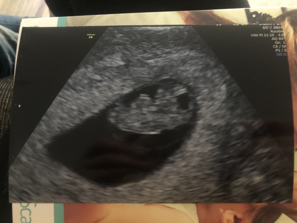 Due May 2021 Thread 2