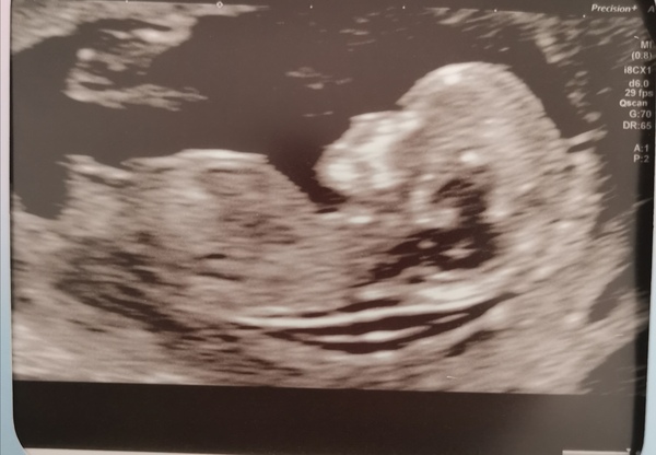 March 2021 #4