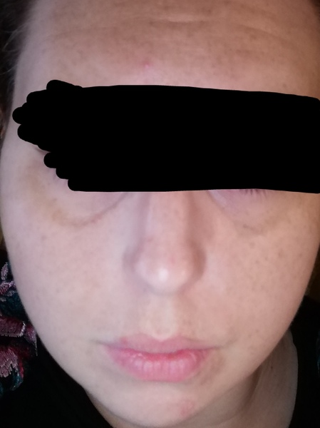 My skin - corpse like