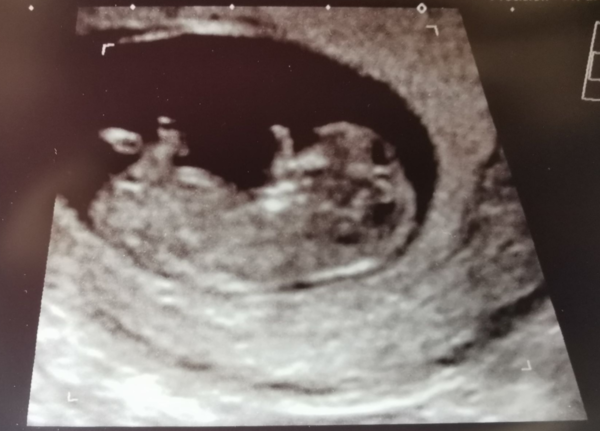 Due April 2021