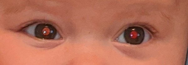 Colour of eye pupil in photos