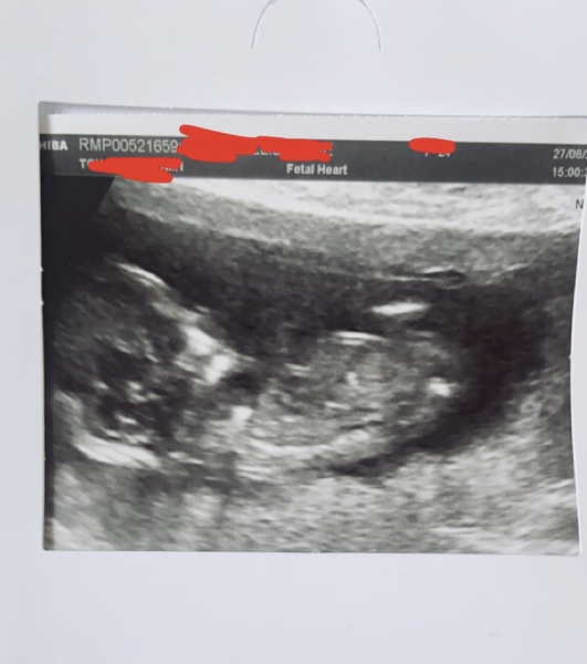 March 2021 #4