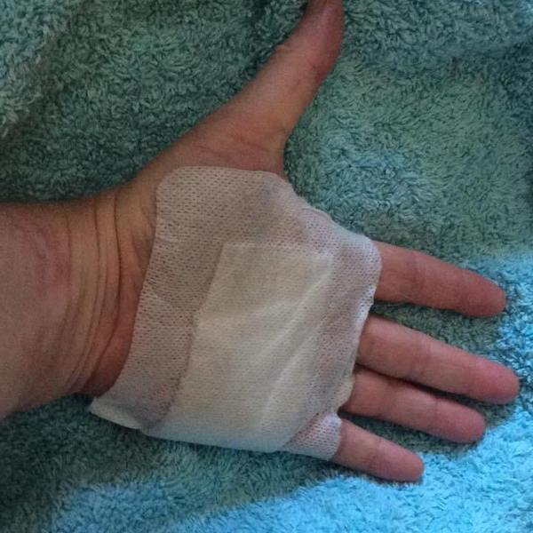 What has been your daftest injury?
