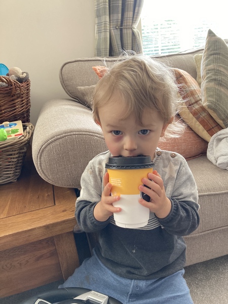 ‘Allergic shiner’? Pic included